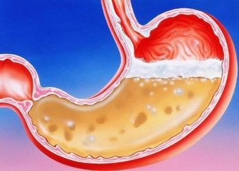 Kết quả của biến đổi hóa học ở dạ dày